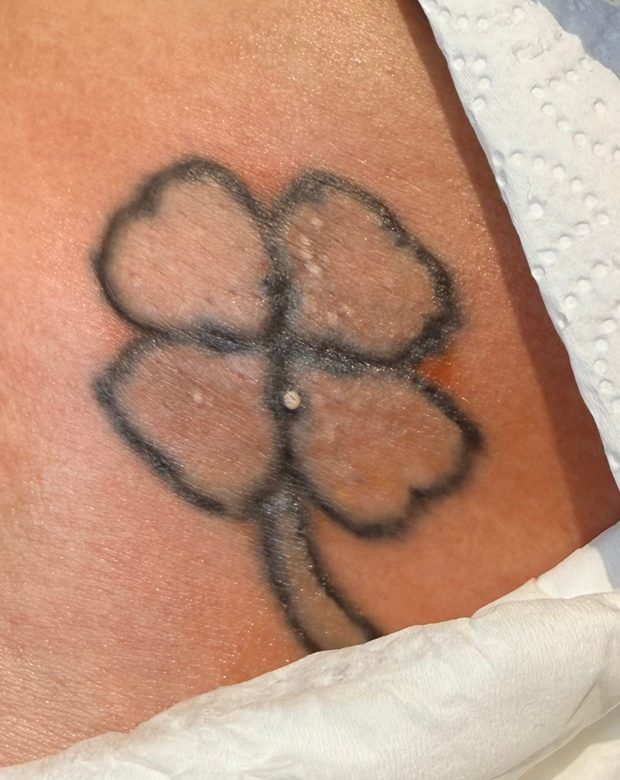 The same clover after treatment, colour cleared
