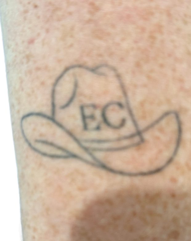 Cowboy hat tattoo on the leg before treatment