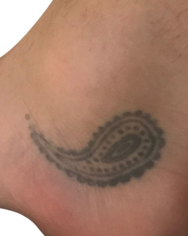 Paisley tattoo on the ankle before treatment